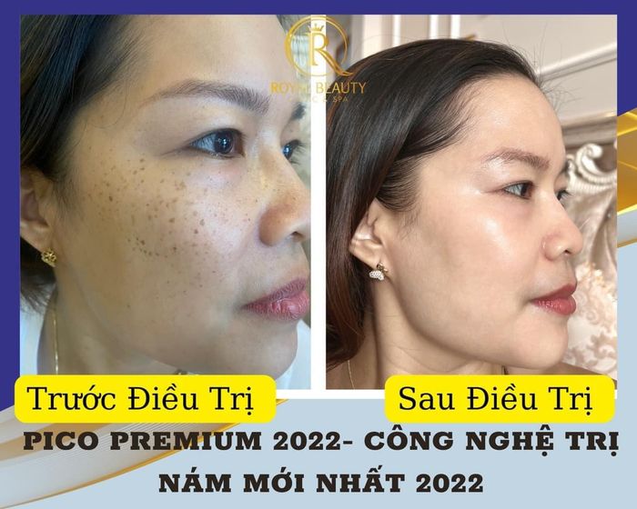 Spa Beauty Royal Quy Nhơn - Hình ảnh 1