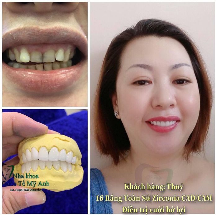 Nha Khoa Quốc Tế Mỹ Anh - Hình 1