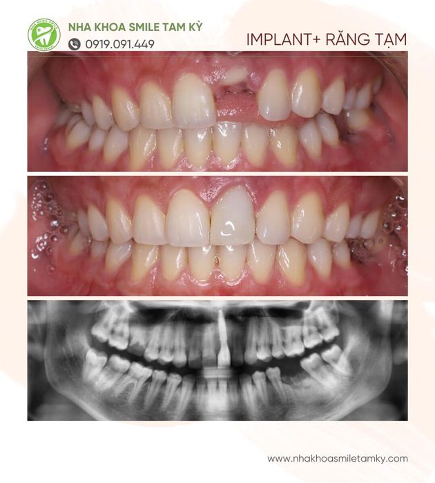 Nha Khoa Smile Tam Kỳ - Hình 2