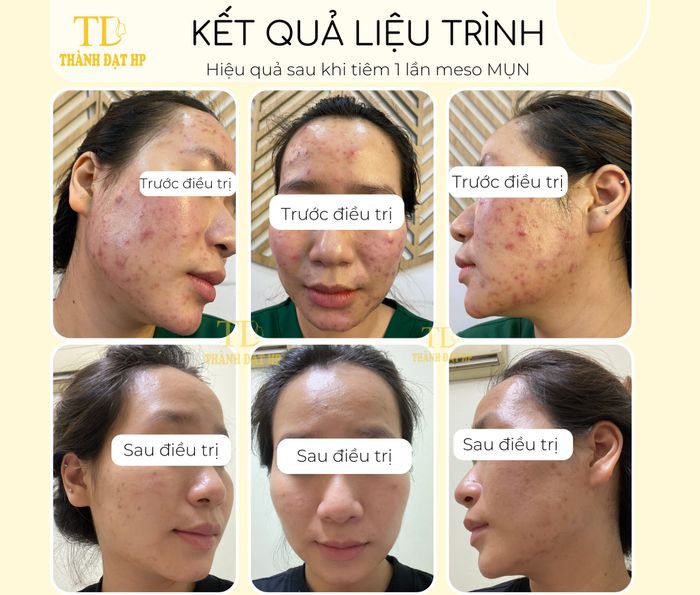 Phòng Khám Da Liễu Thẩm Mỹ Thành Đạt HP - Hình ảnh 2