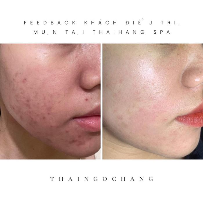 Hình ảnh Thái Hằng Beauty Spa 1