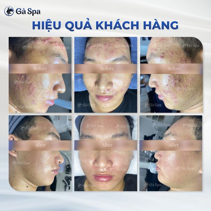 Gà Spa Biên Hòa - Hình ảnh 2