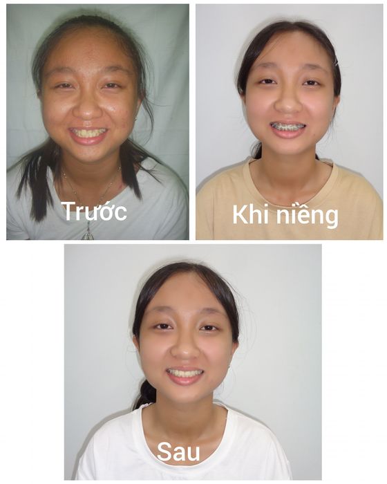 Hình ảnh NHA KHOA BẾN TRE 1