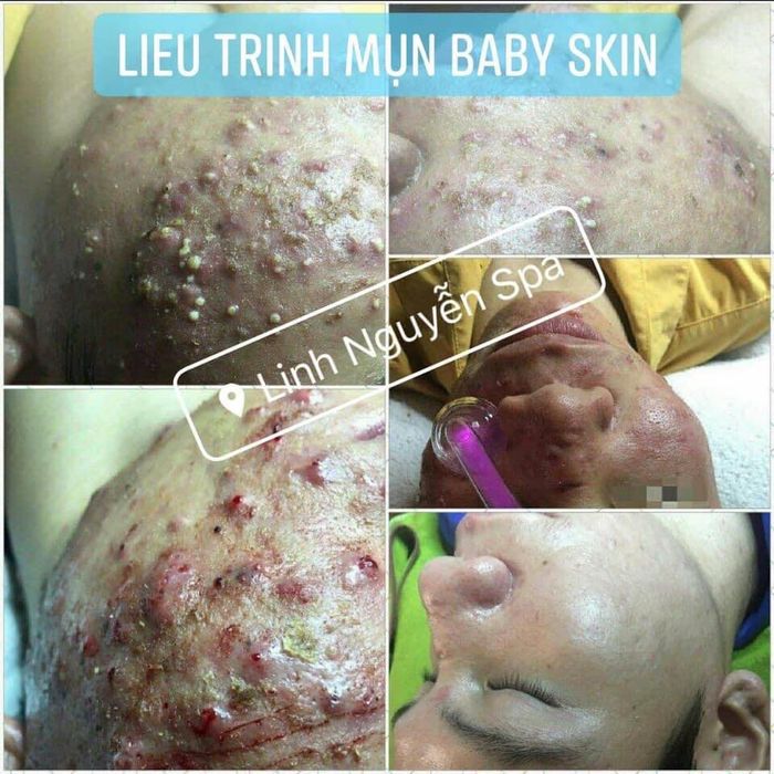 Hình ảnh Linh Nguyễn Spa 1