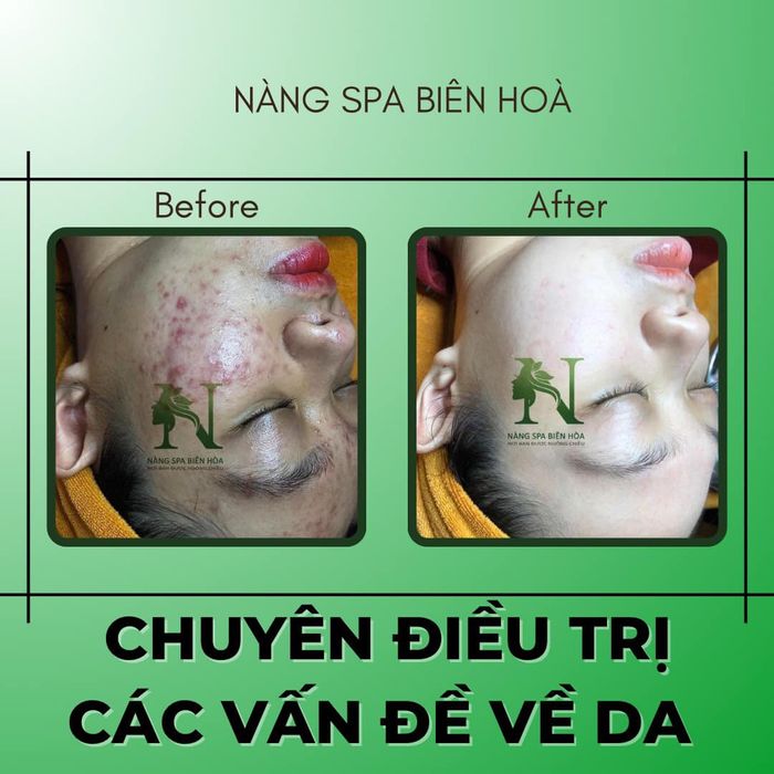 Hình ảnh Nàng Spa Biên Hòa 1