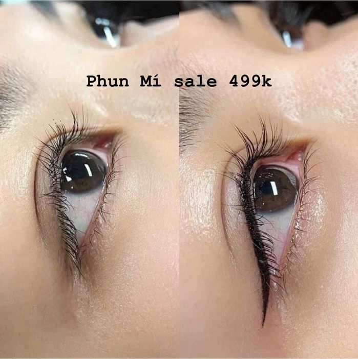 Ảnh 1 của Viện Thẩm Mỹ Hoa Linh Beauty