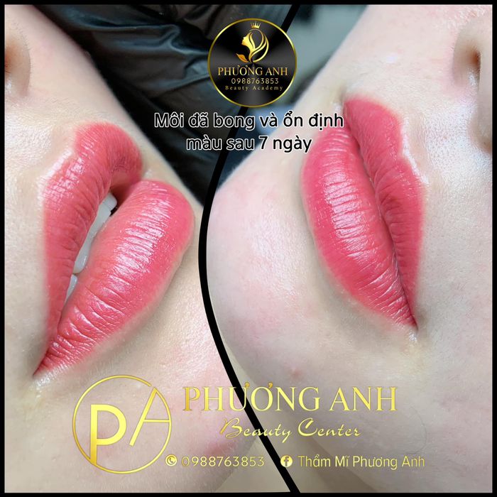 Hình ảnh Thẩm Mỹ Phương Anh 2