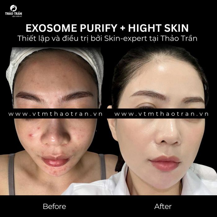 Viện Thẩm mỹ Thảo Trần - Hình ảnh 2