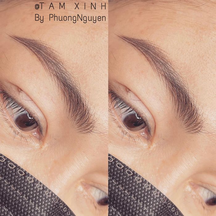 Hình ảnh Thẩm Mỹ Tấm Xinh 1