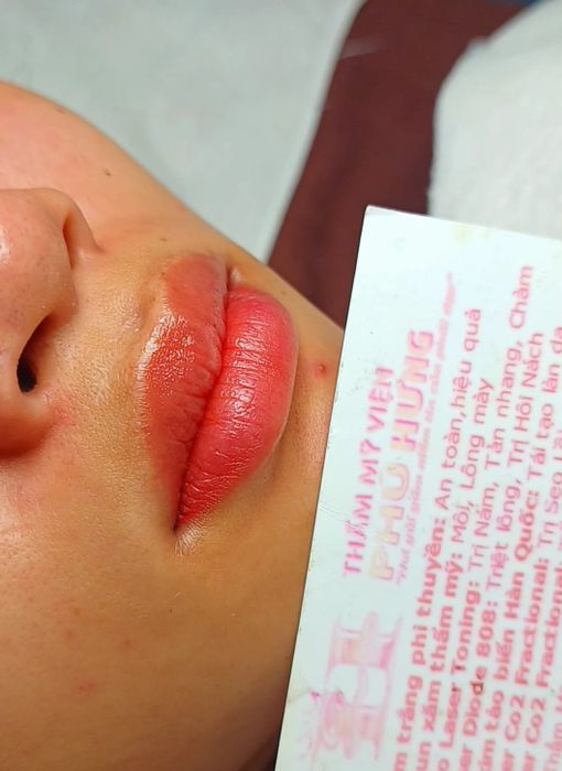 Hình ảnh Thẩm Mỹ Phú Hưng 2