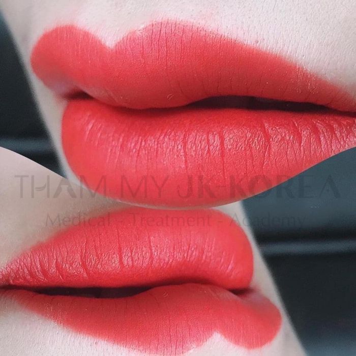 Ảnh 2 của Thẩm Mỹ JK Korea