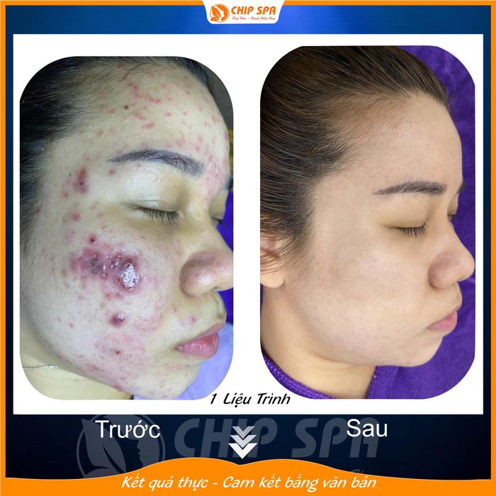 Hình ảnh CHIP SPA BIÊN HÒA 1