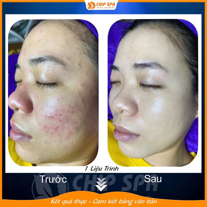 Hình ảnh CHIP SPA BIÊN HÒA 2