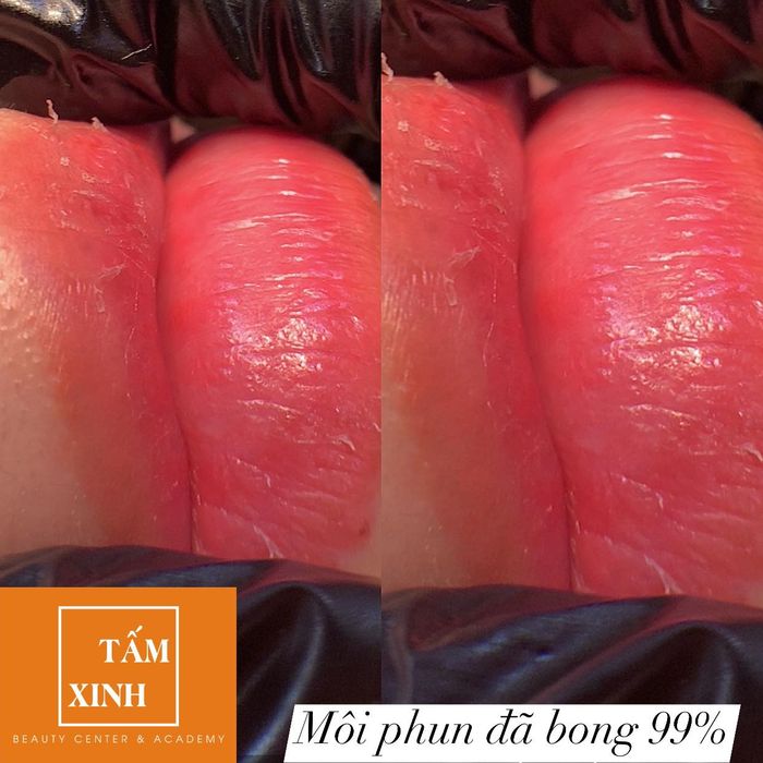 Hình ảnh Thẩm Mỹ Tấm Xinh 2