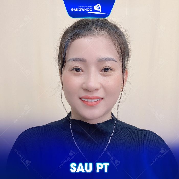 Bệnh viện thẩm mỹ Gangwhoo - Hình ảnh 3