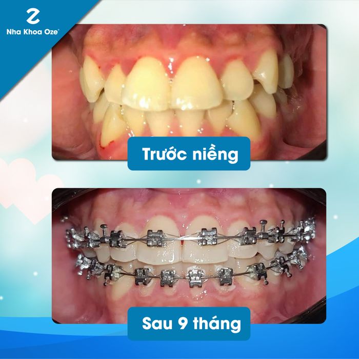 Nha Khoa Oze hình 1