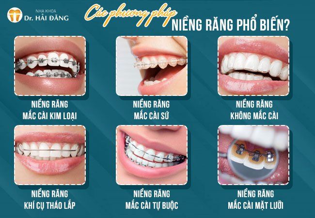 Nha Khoa Hải Đăng - Hình 2