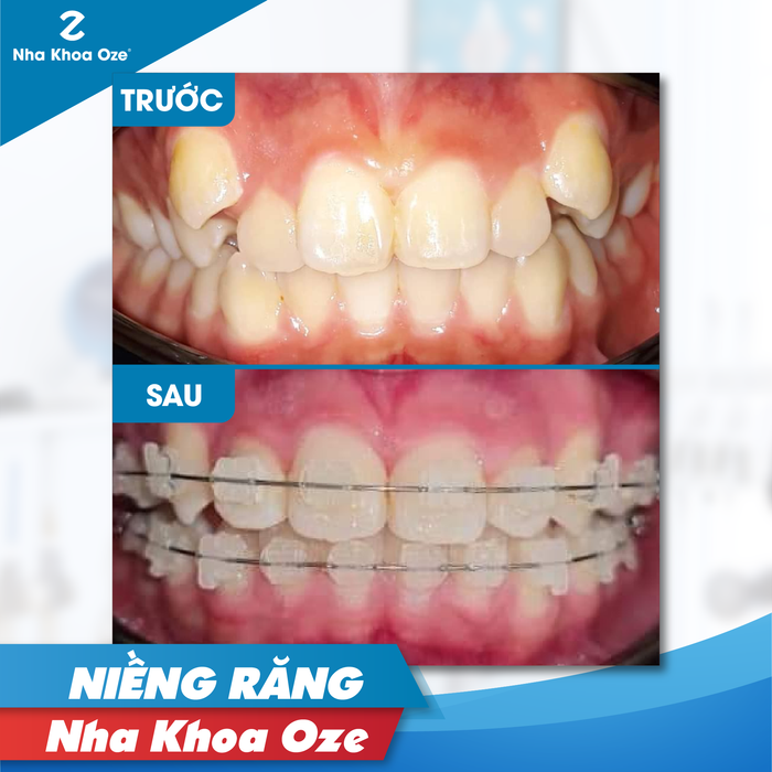 Nha Khoa Oze hình 2
