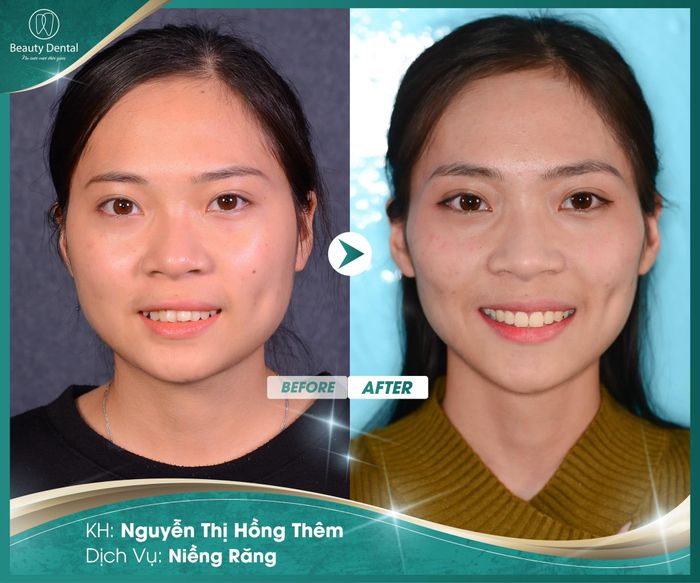 Nha Khoa Beauty Dental hình 1