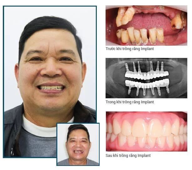 Hình ảnh 2 của Nha Khoa Kim