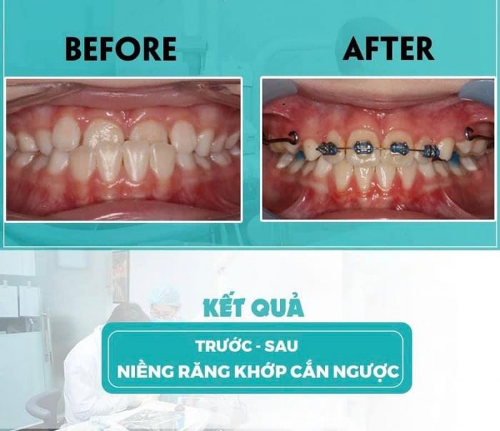 Nha Khoa Quốc Tế Việt Pháp - Hình 1