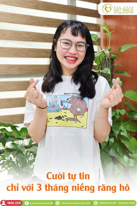 Ảnh Nha khoa VIET SMILE 2