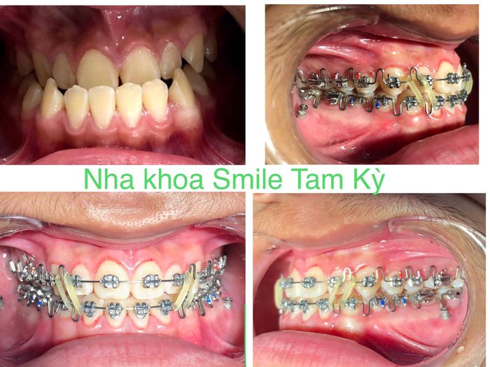 Nha Khoa Smile Tam Kỳ - Hình 2