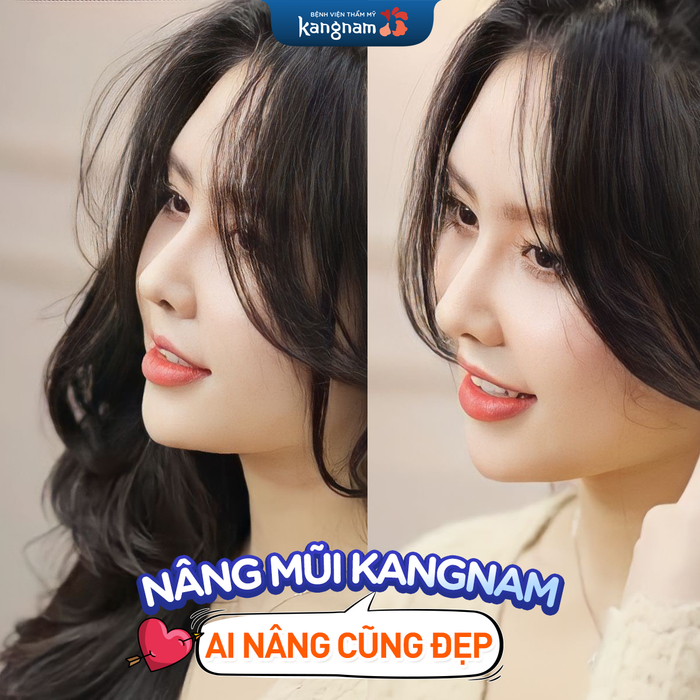 Nâng mũi tại BVTM Kangnam - Hình ảnh 2