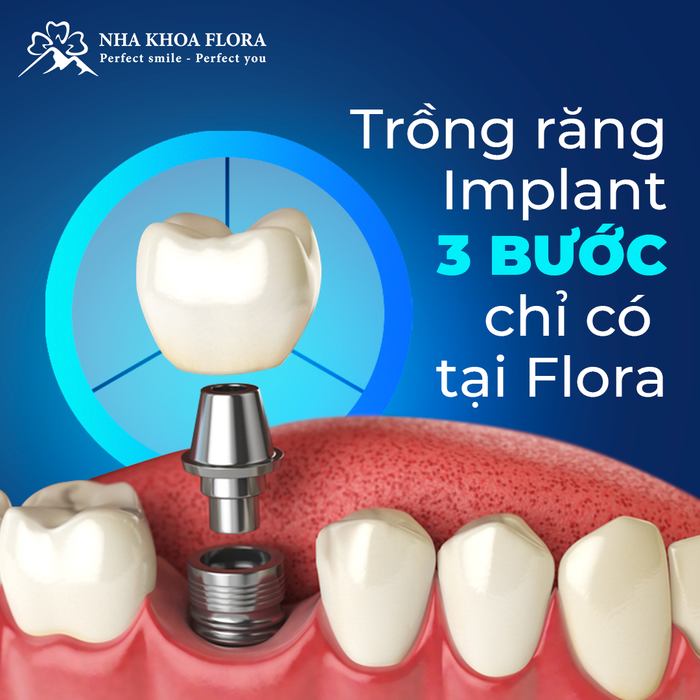 Hình ảnh 2 của Nha Khoa Flora - Hệ Thống Nha Khoa Chuẩn Thụy Sĩ