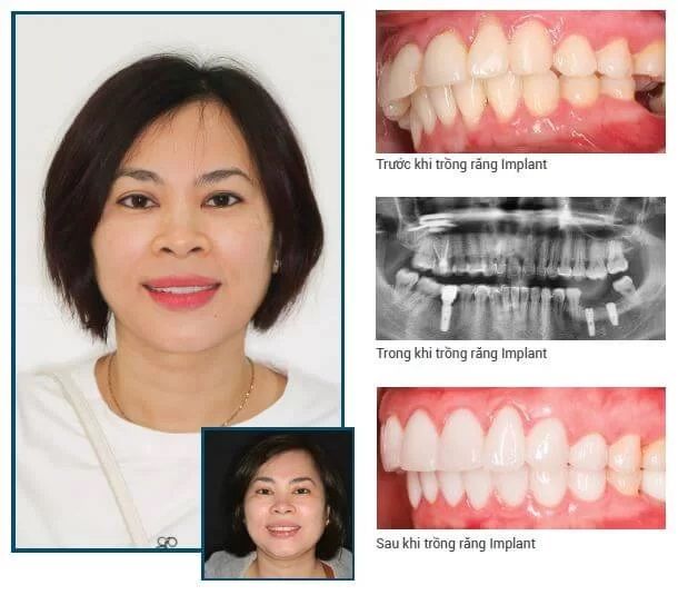 Hình ảnh Nha khoa KIM 1