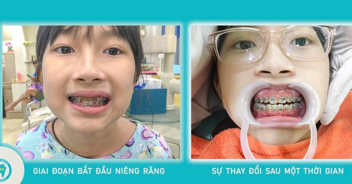 Nha Khoa Quốc Tế K-Da - Hình ảnh 2