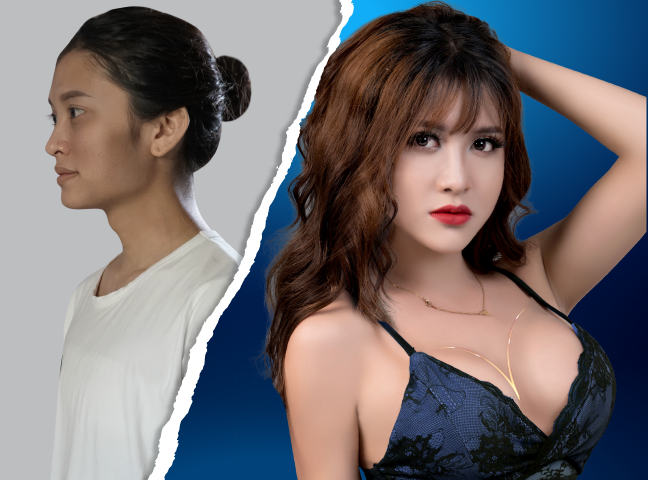 Bệnh viện thẩm mỹ JW Hàn Quốc - Hình 2