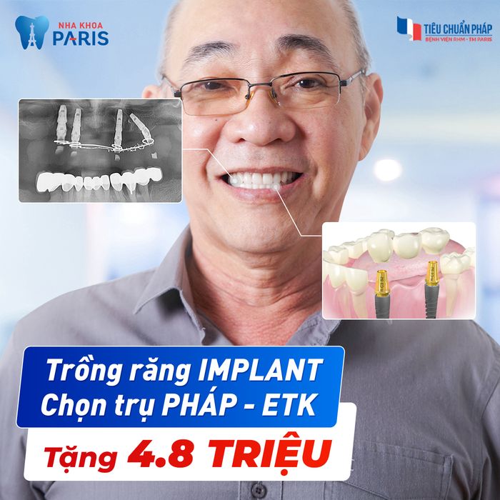 Hình ảnh Nha khoa Paris 1