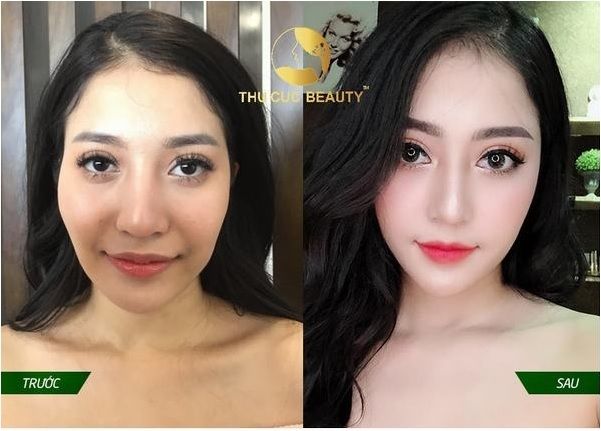 Bệnh viện Thẩm mỹ Thu Cúc - Hình ảnh 1