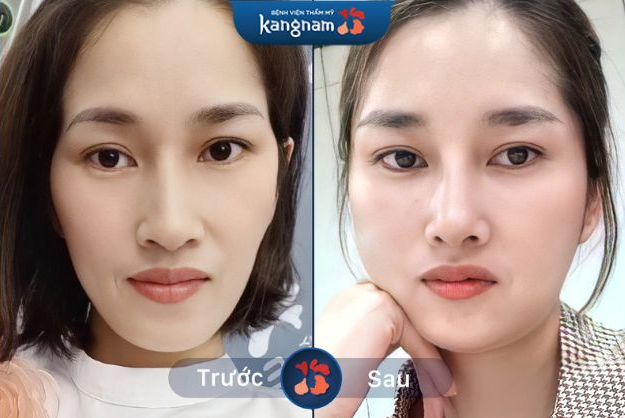 Hình ảnh Bệnh viện Thẩm mỹ Kangnam 2