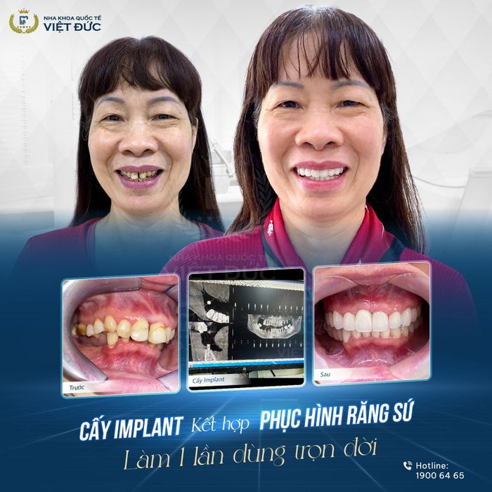 Hình ảnh của Nha khoa Quốc tế Việt Đức 1