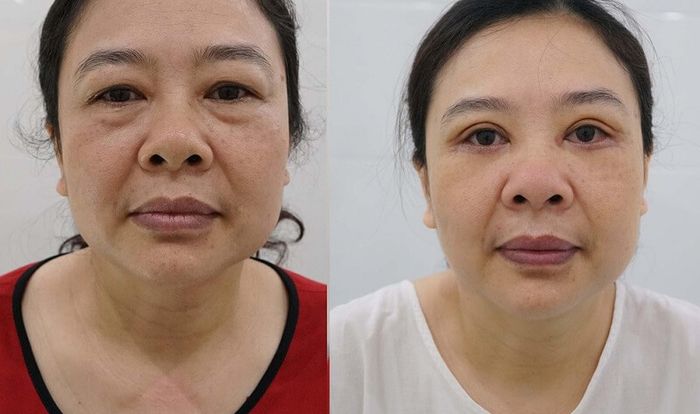 Ảnh trung tâm thẩm mỹ DIVA lần 1