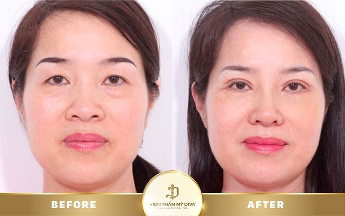 Ảnh trung tâm thẩm mỹ DIVA lần 2