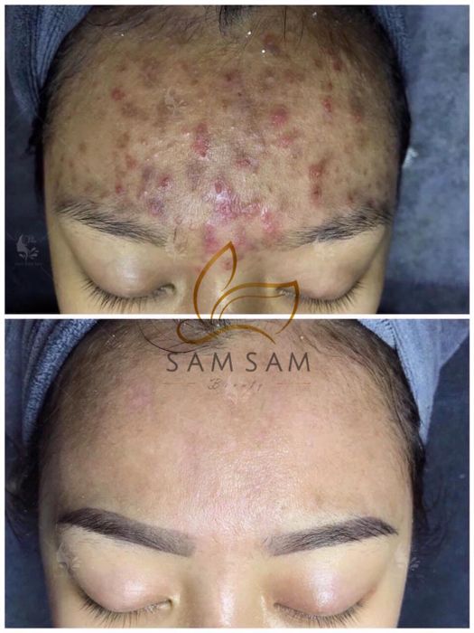 Hình ảnh 2 của Sam Sam Beauty