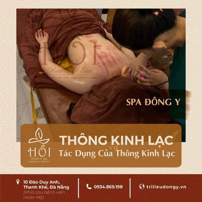 Hồi - Spa Đông Y hình 1