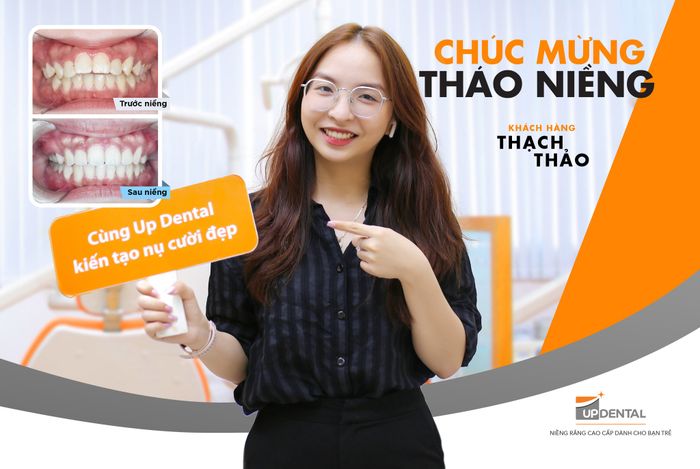 Niềng Răng Hô Up Dental hình ảnh 2