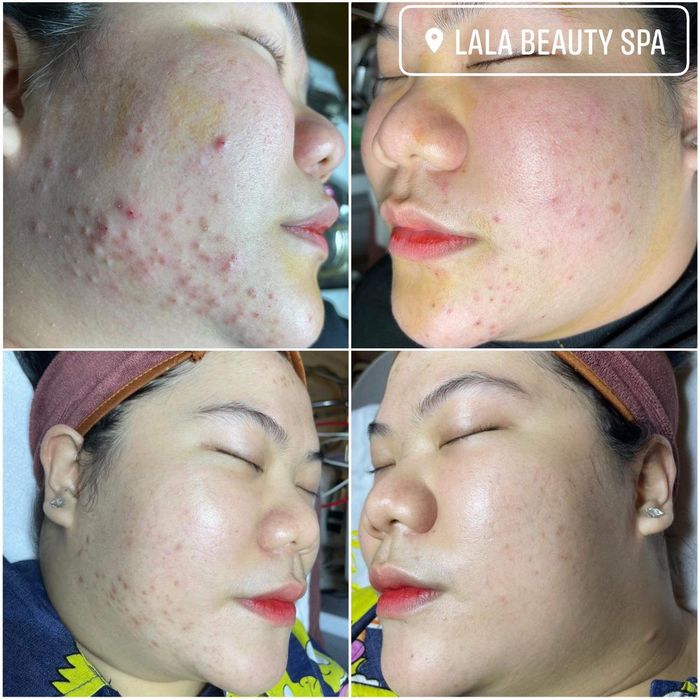 Hình ảnh LaLa Beauty Spa 2