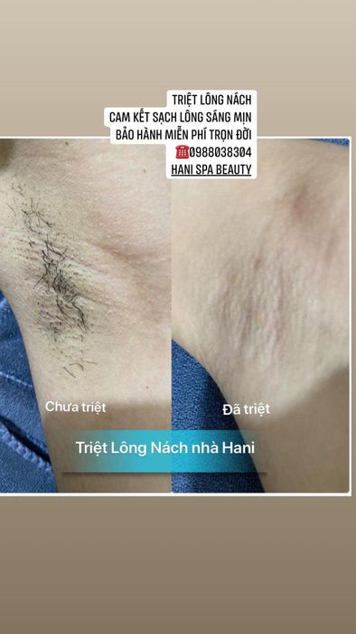 Hani Beauty Spa hình ảnh 2
