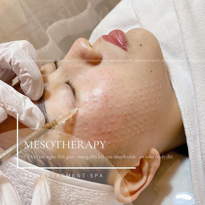 Hình ảnh SKINTREATMENT - Spa & Beauty Natural 1