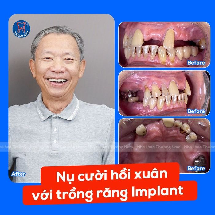 Ảnh 1 của Nha Khoa Phương Nam