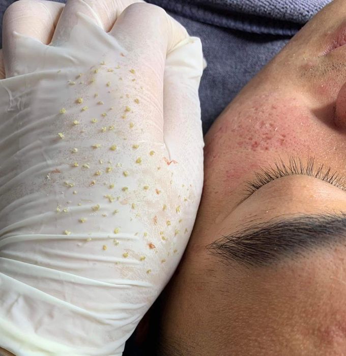 Ảnh Hani Beauty Spa 1