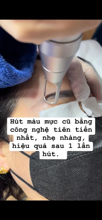 Hình ảnh 1 của Thẩm Mỹ Ngọc Hân TiKi Beauty