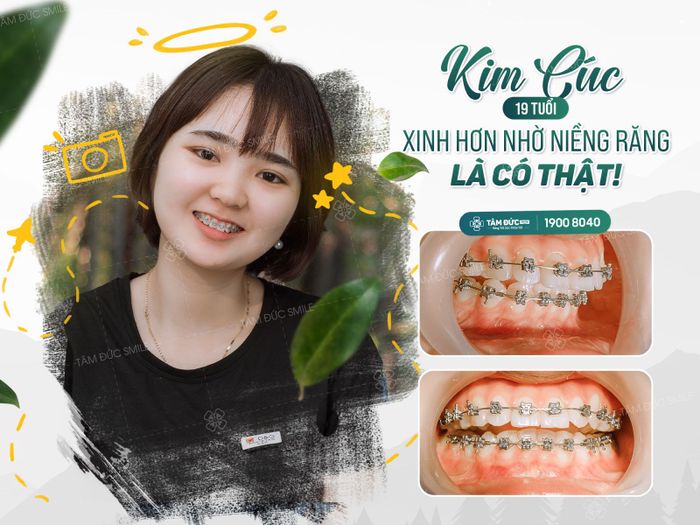 Hình ảnh 2 của Nha Khoa Tâm Đức Smile - Biên Hòa