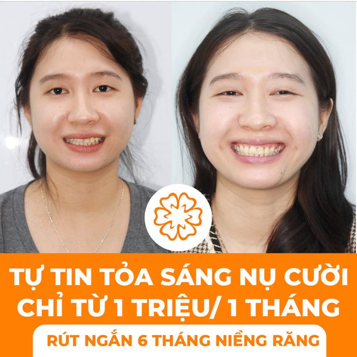 Ảnh của Nha Khoa Adora Sài Gòn 1
