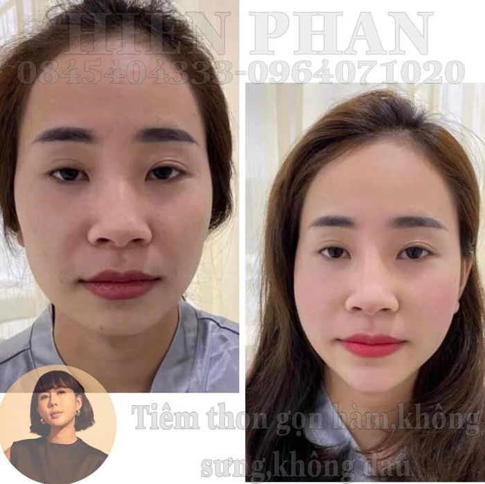 Viện Thẩm Mỹ Hiền Phan hình ảnh 2